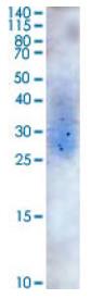 SDS-PAGE (CSF2-1968H).jpg